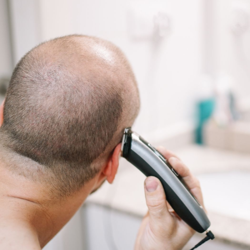 9 Things I Love About Shaving My Head